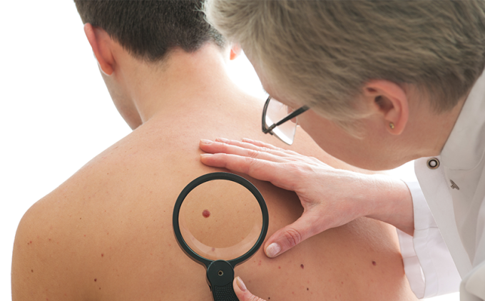 Doctor examines mole on young man's back.